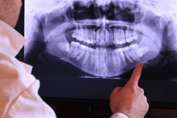 Best Broken or Chipped Tooth Repair in Booneville, AR